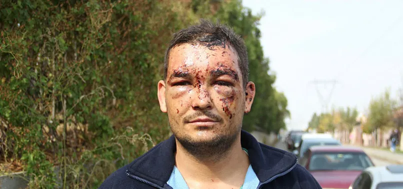 Birden önüne çıktı ve onu bu hale getirdi...