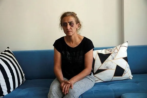 antalyada-yasayan-dilek-goktasin-yardim-cigligi-hayatim-kabus-oldu-olmek-istemiyorum-1623130825168.jpeg Antalya’da yaşayan Dilek Göktaş’ın yardım çığlığı: Hayatım kâbus oldu ölmek istemiyorum - 4