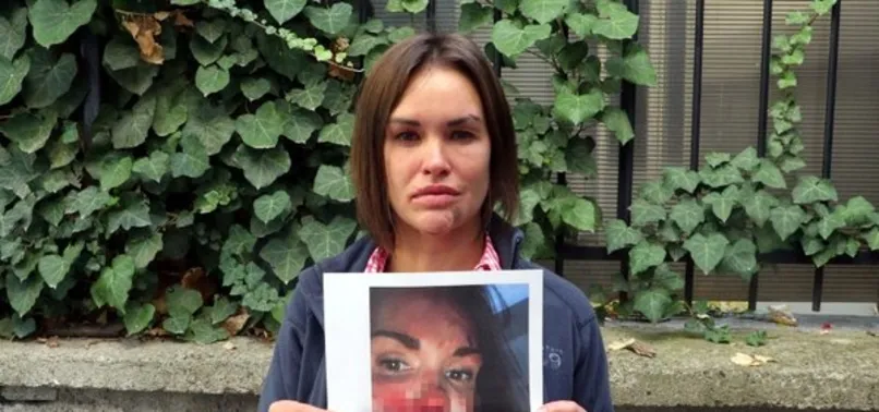 Kocası tarafından darbedilen kadın savcılığa gitmişti! Rus kadın ölü bulundu