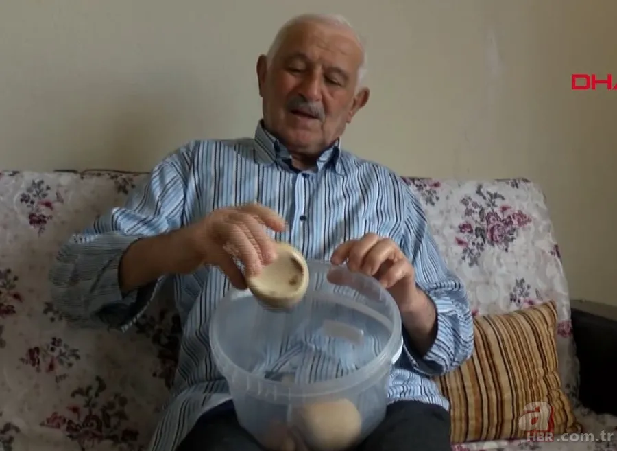 Karın bölgesinde şişlik ve halsizlik şikayetiyle doktora gitti! Karnından çıkanlar şoke etti 22