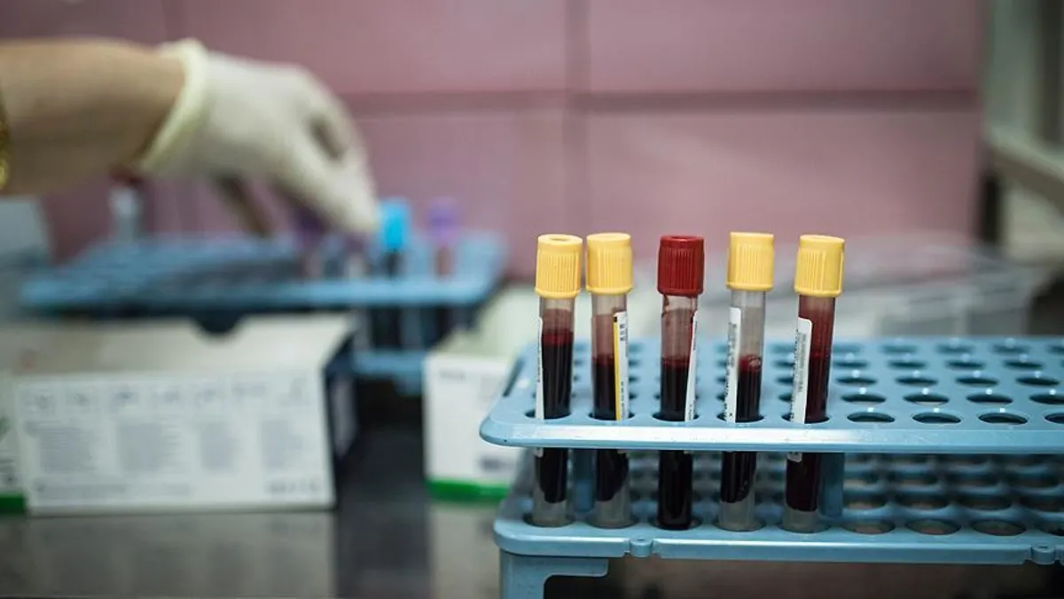 Kanseri tespit edebilen kan testi yüzde 99 doğruluk oranına ulaştı
