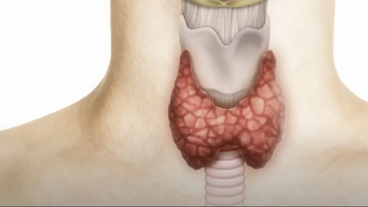 Fazla tiroit göze ve kalbe vuruyor!