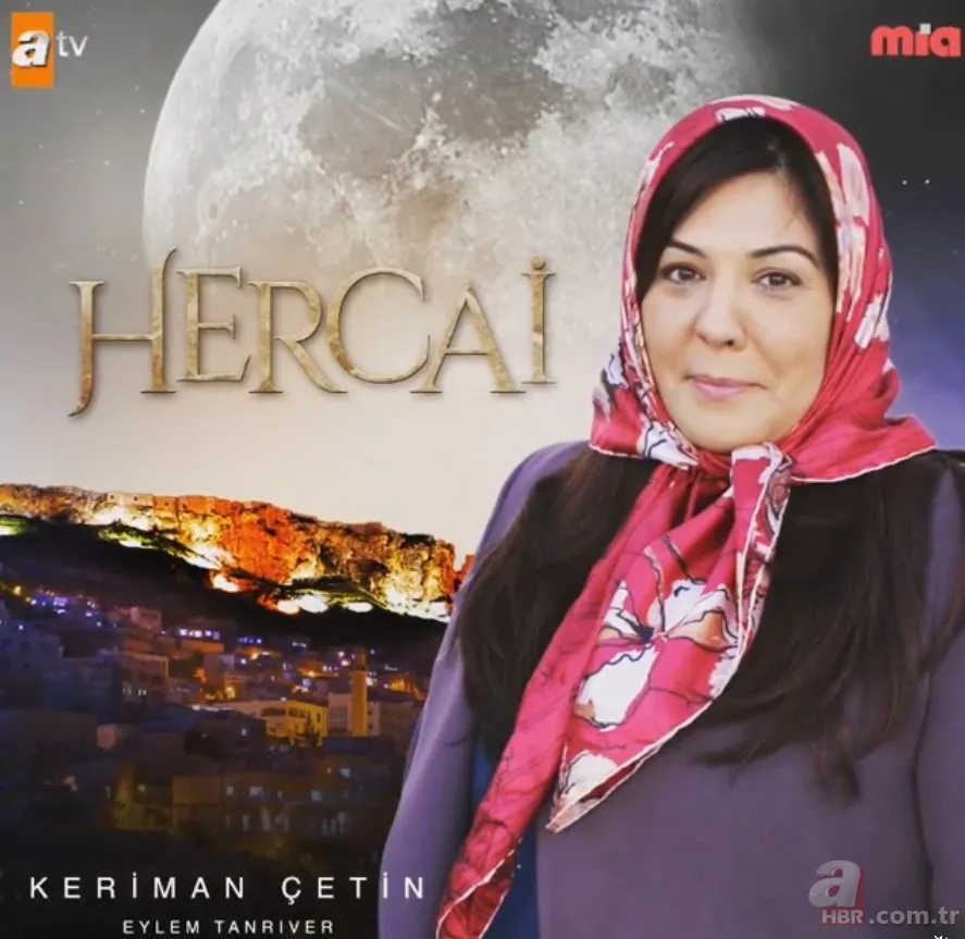 Estetik felç bırakmış! Hercai'nin yıldızı Eylem Tanrıver'in hayatı karardı 3