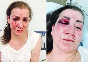 Almanya'da Türk kadına tramvayda saldırı