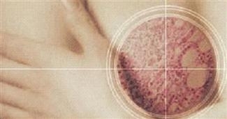 Tümörü yüzde yüz tespit ediyor