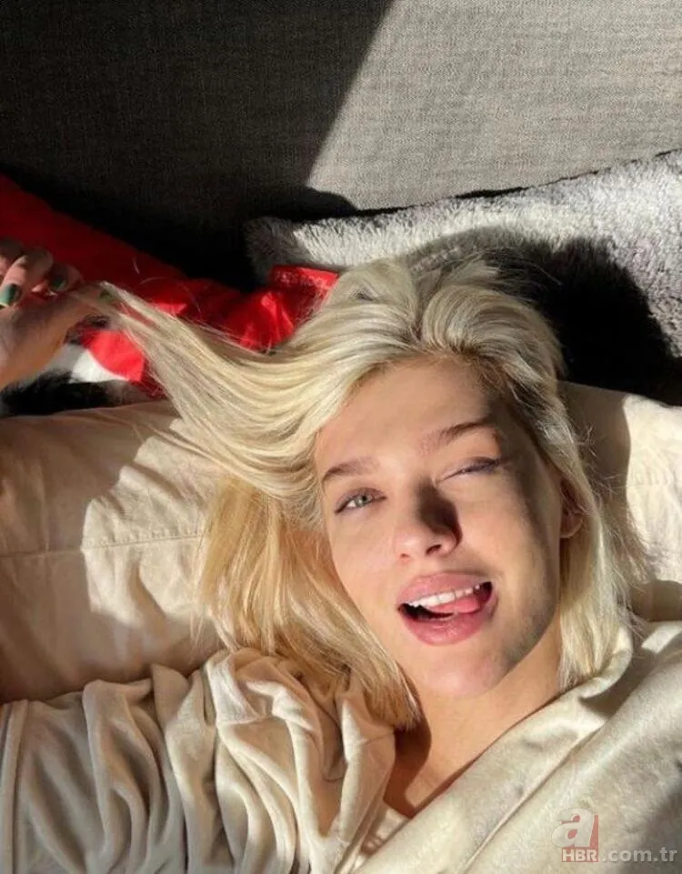 Hayal Köseoğlu'nu gören tanıyamadı! Estetiksiz hali şoke etti 6