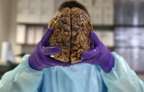 Burası bir beyin bankası!