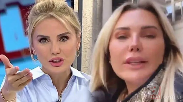 Ece Erken'in yüzüne ne oldu? Erken’in son hali şoke etti! 5