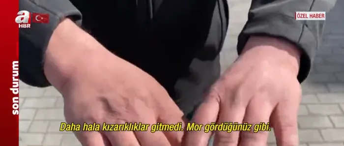 Alman polisinden Türk iş insanına saldırı! Yaşadığı dehşeti A Haber'e anlattı: Sonumun George Floyd gibi olmasından korktum - 3