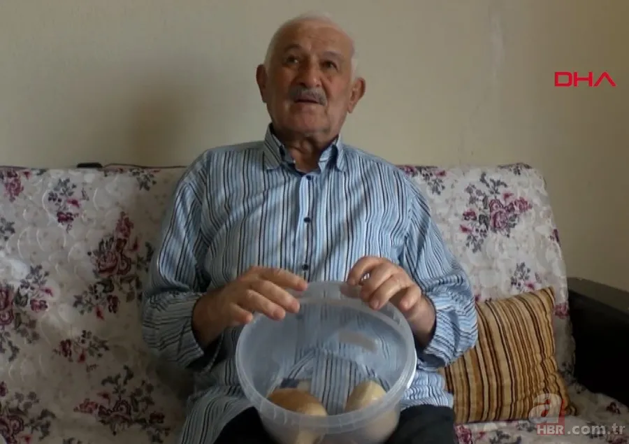 Karın bölgesinde şişlik ve halsizlik şikayetiyle doktora gitti! Karnından çıkanlar şoke etti 21