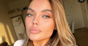 Ukraynalı model balkondan düşmüştü!