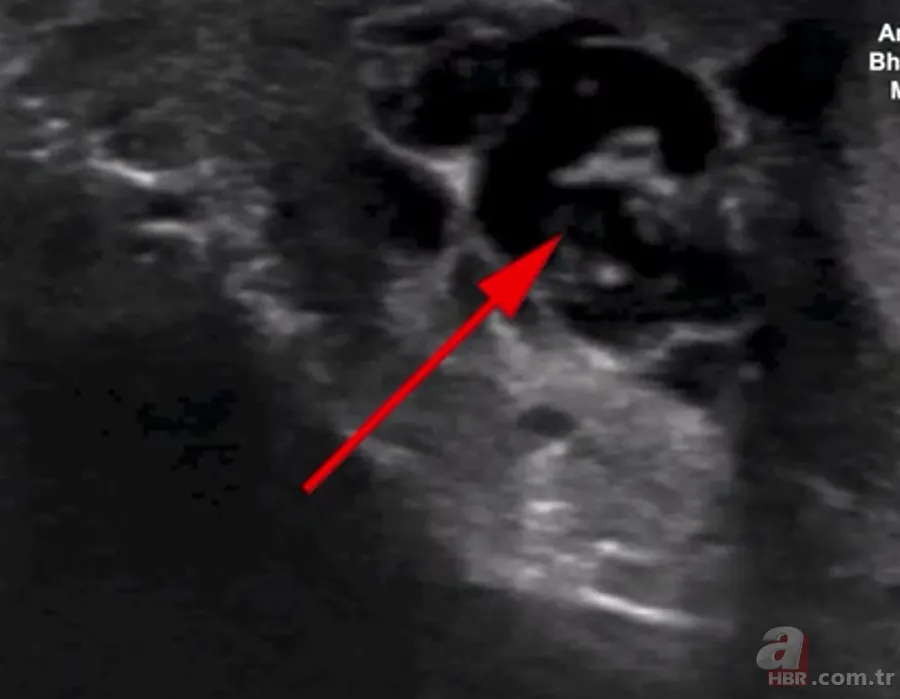 Doktora gitti hayatının şokunu yaşadı 👨⚕️ Sivrisinek ısırığı kabusu oldu 🦟 Dans eden düzinelerce... 7