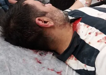 CHP'li Adalar Belediyesi'nin usulsüzlüklerini ifşa etti! Yaşam savaşı veriyor