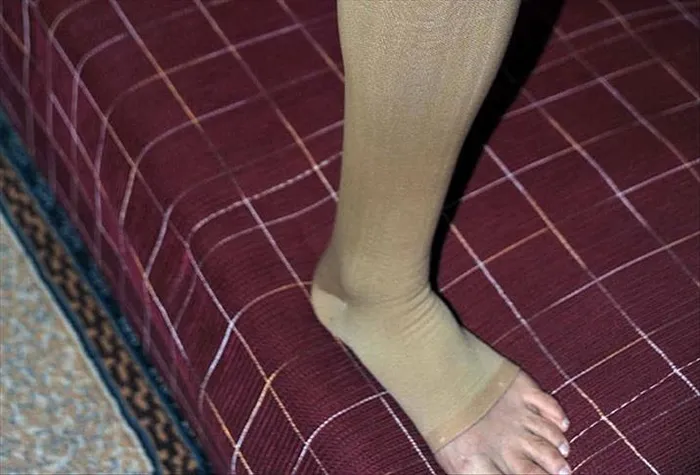 Sıcak kum ve şortlar varisi tetikliyor