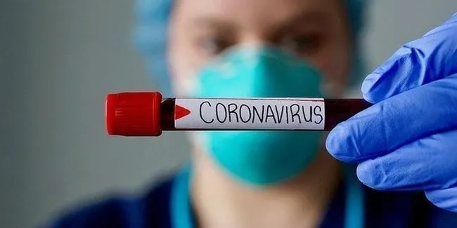 Koronavirüs aşısında tarihi gün! Türkiye’de ilk deneme yapıldı - 7