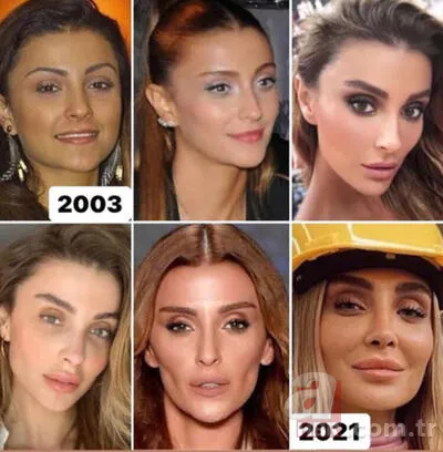 Işın Karaca da estetik kervanına katıldı! Son halini paylaştı 11