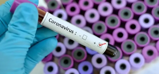 Kan grubu “A” olanların, koronavirüse yakalanma riski daha fazla