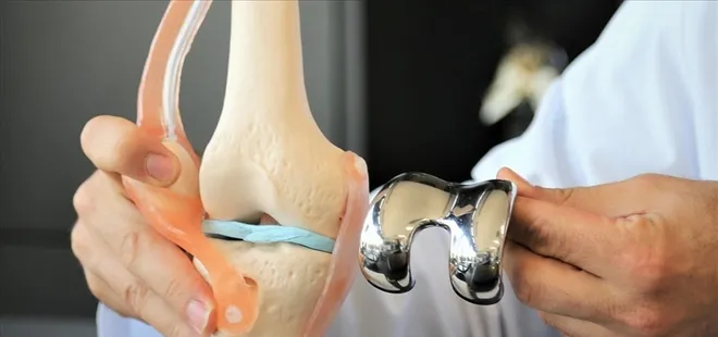 Bu hastalığa dikkat! 50 yaşından sonra daha sık görülüyor!