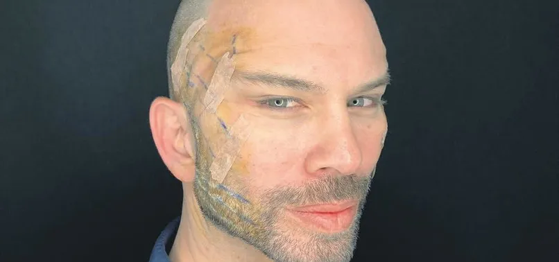 Berksan Fransız askısı yaptırdı! O anları canlı canlı paylaştı