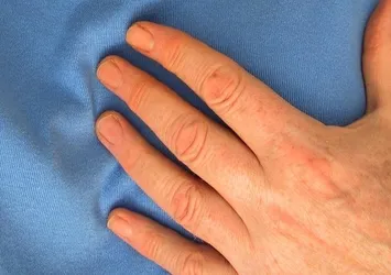 Kalp doktoru felç riskini artıran besinleri açıkladı!