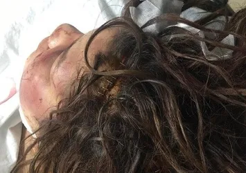Şanlıurfa'da kan donduran olay! Odaya kapatıp 5 gün boyunca işkence yaptı...