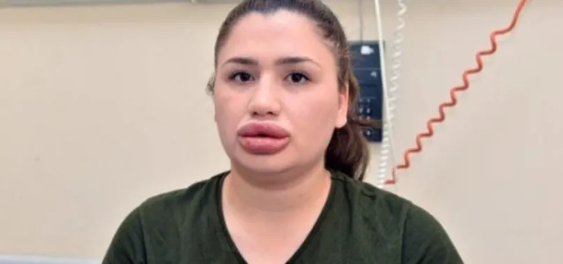 Silikon mağduru hemşirenin son hali