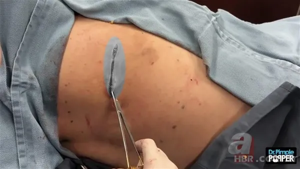 30 yıl boyunca baş ağrısıyla yaşadı! Nedeni şoke etti... 135