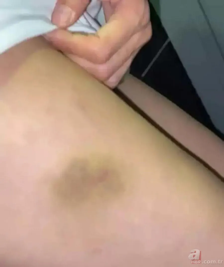 Survivor yarışmacısı Yunus Emre Özden hakkında şok suçlama! Sevgilisine kabusu yaşattı 5