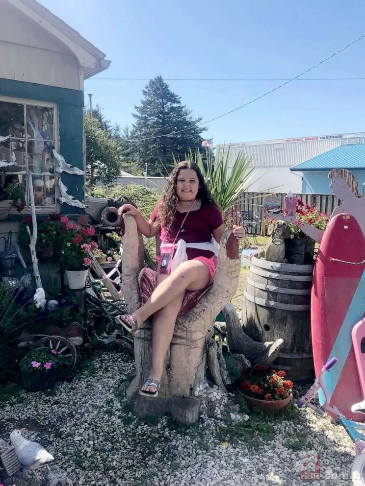 TikTok'taki meydan okuma hastanede bitti! Kendisini yaktı 8