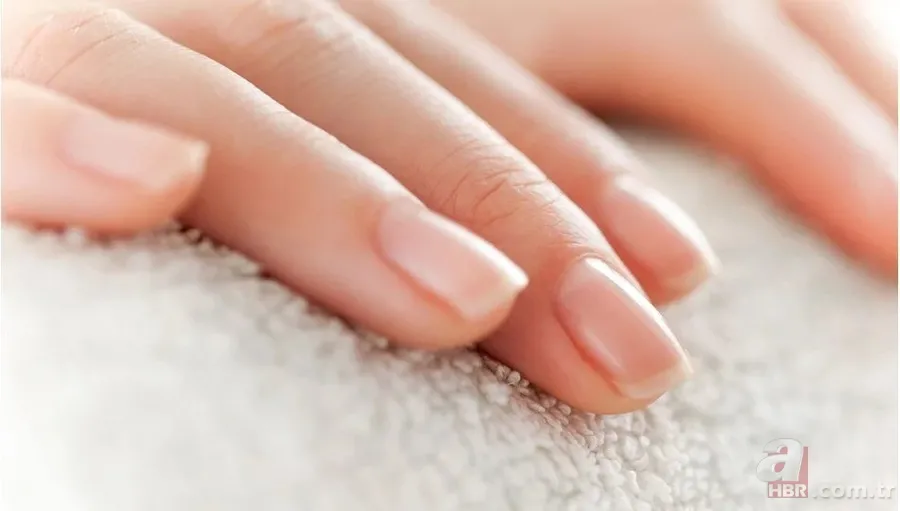 Tırnak diplerinizi kontrol edin! Belki de bu hastalıklardan birine sahipsiniz... 8