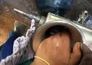 Elini kıyma makinesine kaptırdı
