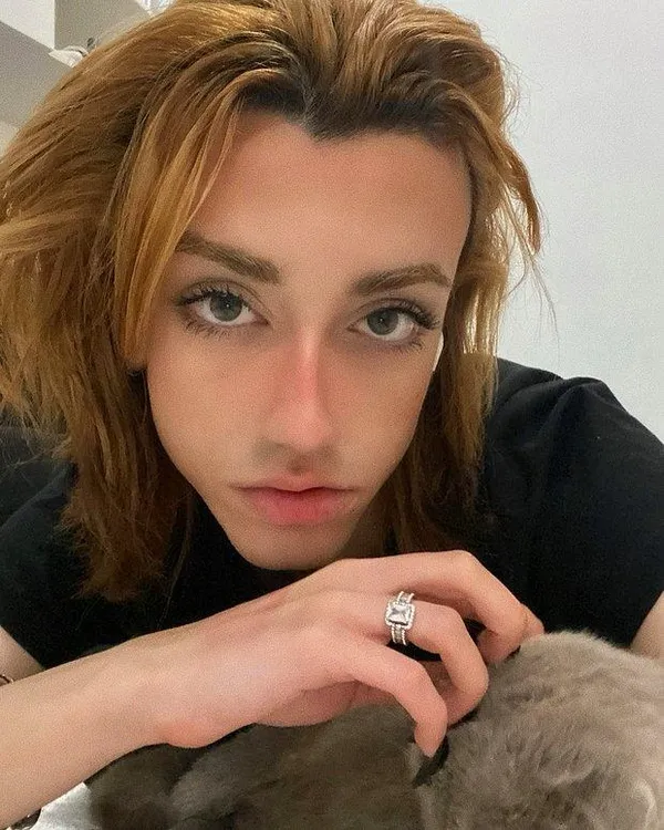 Mika Raun kimdir, kaç yaşındadır? Fenomen Mika Raun son hali nasıl?