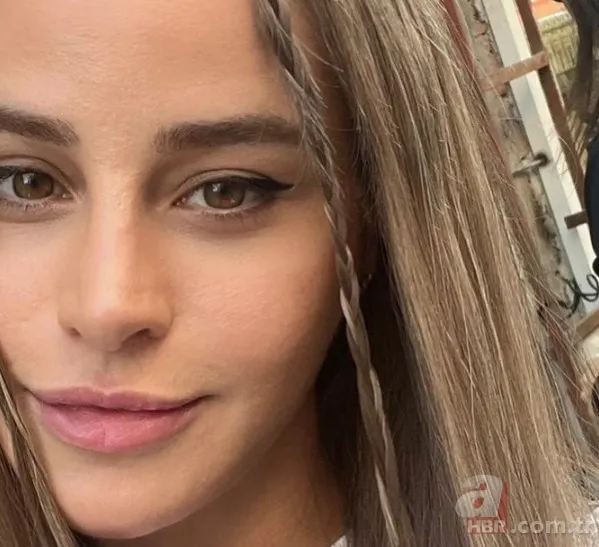 Büşra Pekin’de estetikle yeni birine dönüşenler kervanında! 1 estetiğim var deyince ti’ye alınmıştı… 4 bantla o hale gelmiş! 10