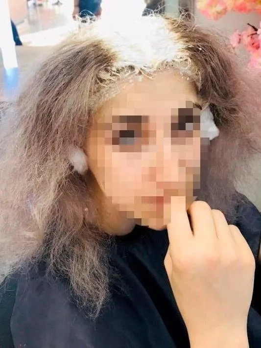 saclarini-boyatmak-icin-kuafore-gitti-kafatasi-derisi-yandi-1606111990724.jpeg İstanbul’da saçını boyatmak isteyen kadının kafatası derisi yandı - 2