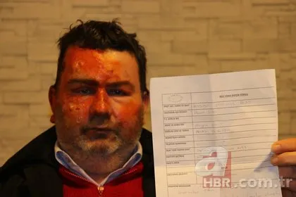 Uyurken hayatı altüst oldu! Kardeşinin yüzüğünü yaktığını söyledi: Ne iyi yaptım, seni yaktım