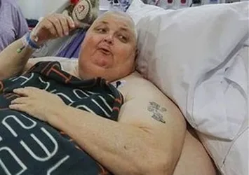 Karnından 59 kilogramlık tümör çıktı