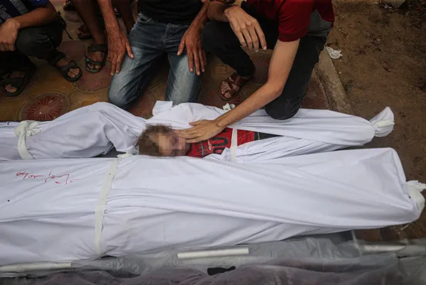 1698824093911.jpg Gazze'de insanlık suçu! Katili İsrail bir yaşını doldurmamış 133 bebeği öldürdü! Filistinli kadınların çaresizliği: Fener ışığında anestezisiz sezaryan doğum - 5