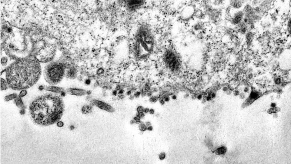 Bilim insanları görüntüledi: Corona virüsün hücreye saldırı anı!