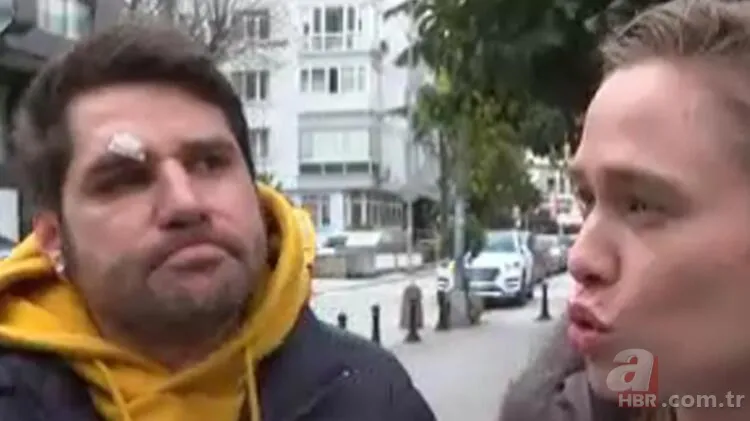 Ceyhun Fersoy ve Begüm Öner mekanda saldırıya uğradı! Darp görüntüleri ortaya çıktı 2