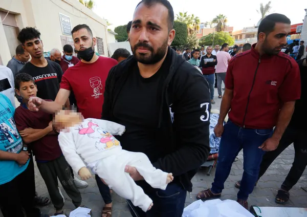 1698824095297.jpg Gazze'de insanlık suçu! Katili İsrail bir yaşını doldurmamış 133 bebeği öldürdü! Filistinli kadınların çaresizliği: Fener ışığında anestezisiz sezaryan doğum - 1