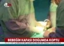Korkunç olay! Bebeğin kafası doğumda koptu