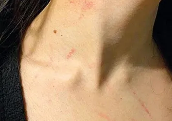 Lüks otelde taciz dehşeti! Sözleri kan dondurdu...