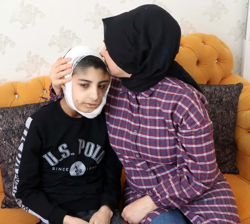 Çenesinin altına kadar indi! Yüzündeki yara her geçen gün büyüyor
