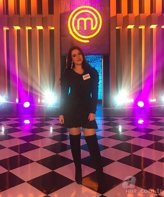 Eski MasterChef yarışmacısı bıçaklandı! Eslem Sena Yurt yaşadığı olayı anlattı 3
