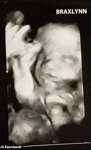 ABD’de arkadaşını katledip karnından bebeğini çaldı! O cani için karar