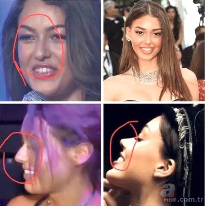 Seda Sayan'ın son hali şaşkına çevirdi! Estetik sonrası... 22