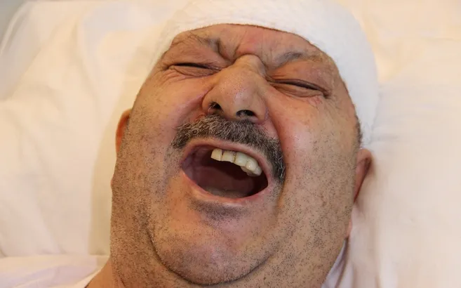 Diş ağrısı sanıp 6 sağlam dişini çektirdi! Gerçek bambaşka çıktı: Delirten Hastalık