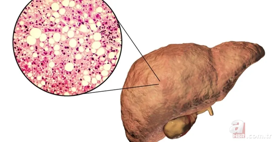 Orucun faydaları neler? 29 Günlük orucun vücudumuzdaki etkileri neler? Sağlığa faydası saymakla bitmiyor! Hangi organlara iyi gelir? 8