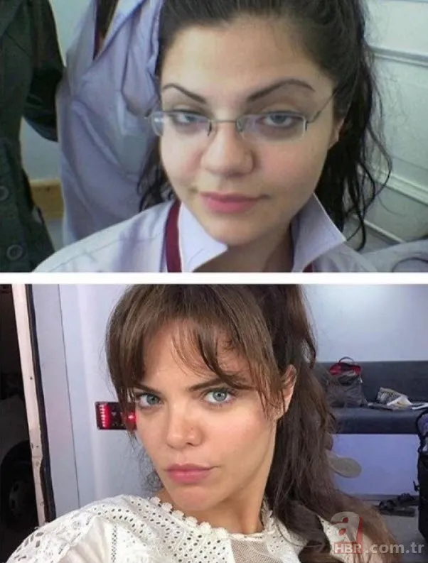 Pınar Dilşeker görenleri şoke etti! Yaptırdığı estetiklerle öyle bir hale geldi ki tanımak imkansız 11