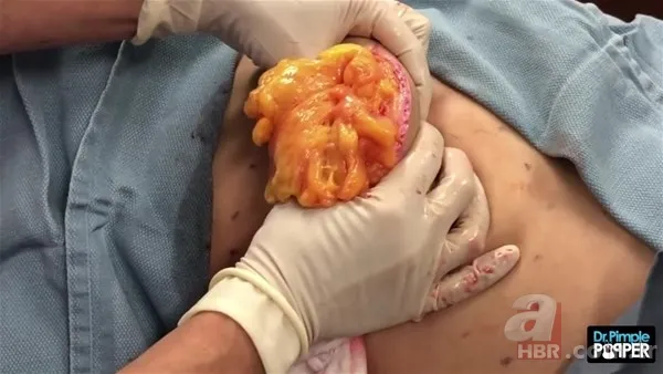 30 yıl boyunca baş ağrısıyla yaşadı! Nedeni şoke etti... 129